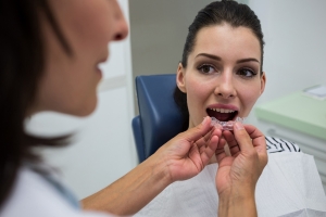 Invisalign and clear aligners Invisalign and clear aligners